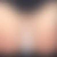 状態異常 -  アンホーリーメイデン攻略